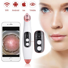 Visible Camera Blackhead Remover Vacuum Suction FLIXME WORLD