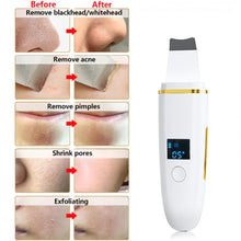 Ultrasonic Skin Scrubber FLIXME WORLD